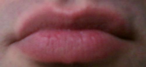 000-lips